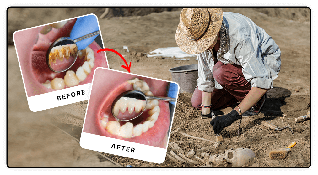 Ancient dental health secret